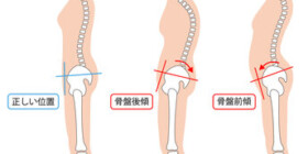 別府市で産後歪み、開きでお困りの方